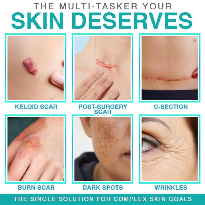 BBOJI® 3-in-1 micronaaldverzorgingspatch - Afbeelding 3