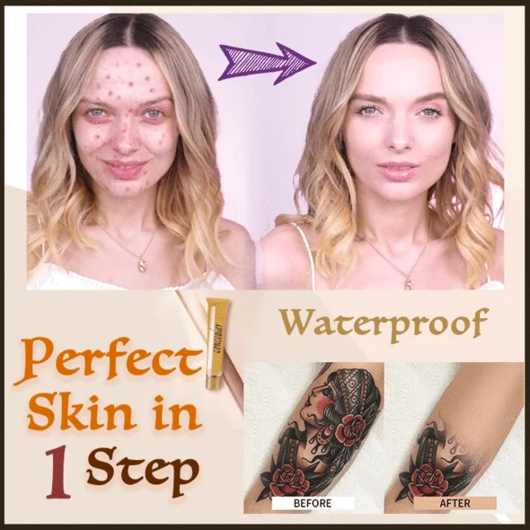 Electromatic haar-epilator