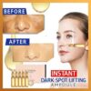 Instant Dark Spot Lifting-ampul
