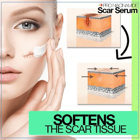 PRO Niacinamide littekenserum - Afbeelding 2