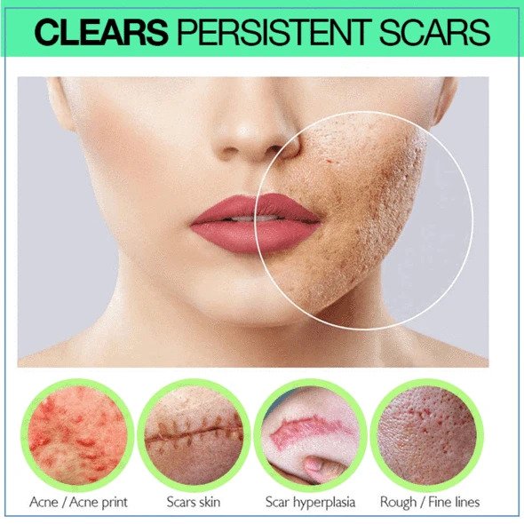 PRO Niacinamide littekenserum - Afbeelding 3