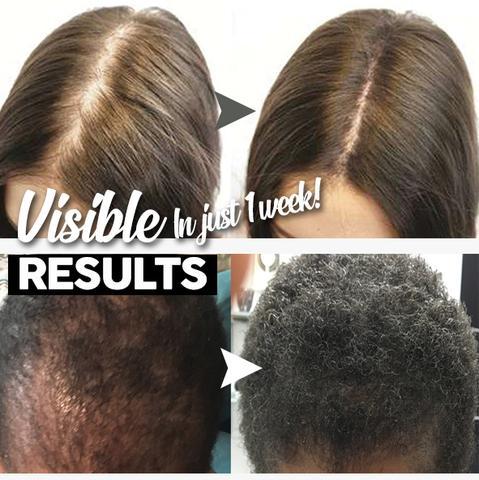 Haargroei Shampoo Bar - Afbeelding 4