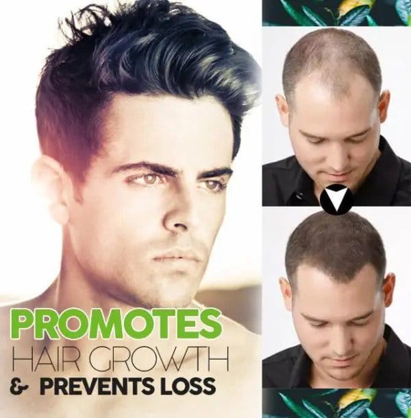 Biologische haarverduisteringsoplossing - Afbeelding 3