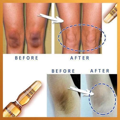 Instant Dark Spot Lifting-ampul - Afbeelding 4