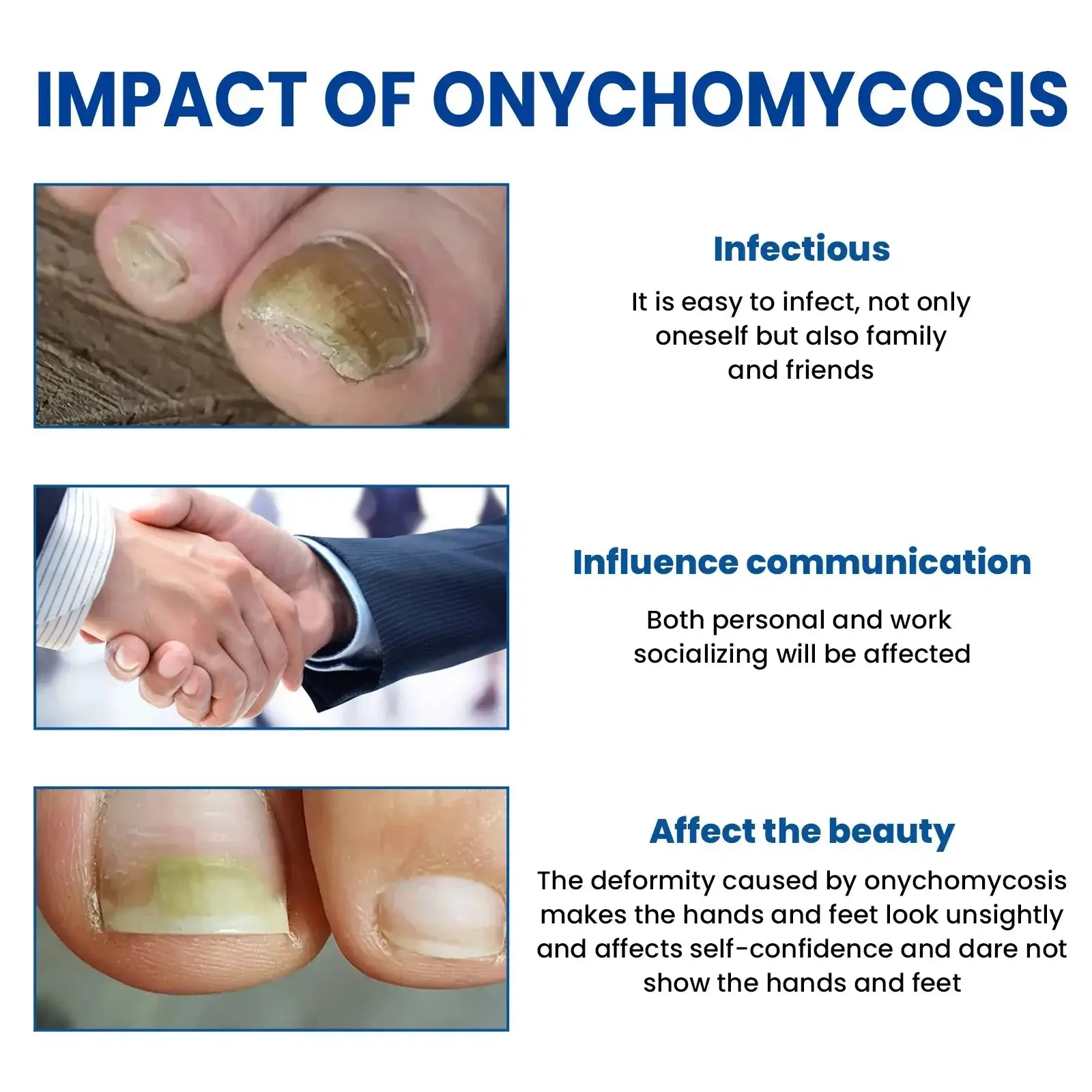 Reparatiepleisters voor schimmelnagels - Afbeelding 2