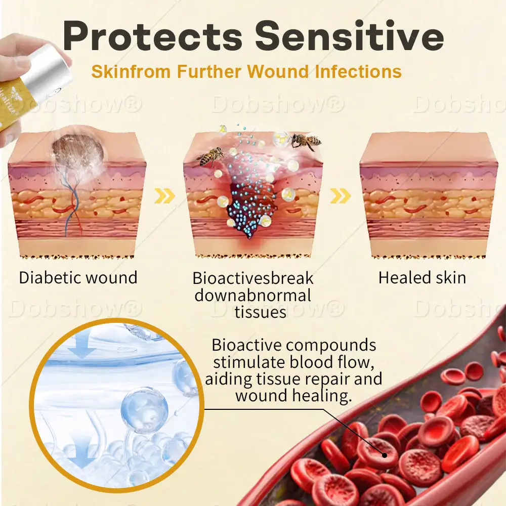 GlucoShield Bijengif Wondspray - Afbeelding 3