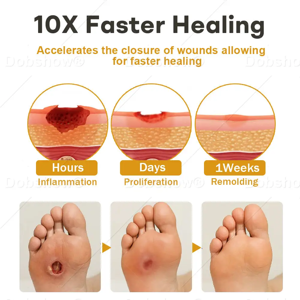 GlucoShield Bijengif Wondspray - Afbeelding 4