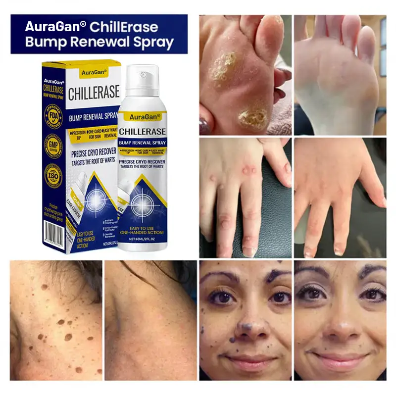 ChillErase Bump Vernieuwingsspray - Afbeelding 4