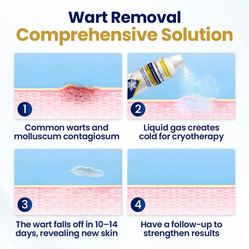 ChillErase Bump & Skin Tag vernieuwingsspray - Afbeelding 4