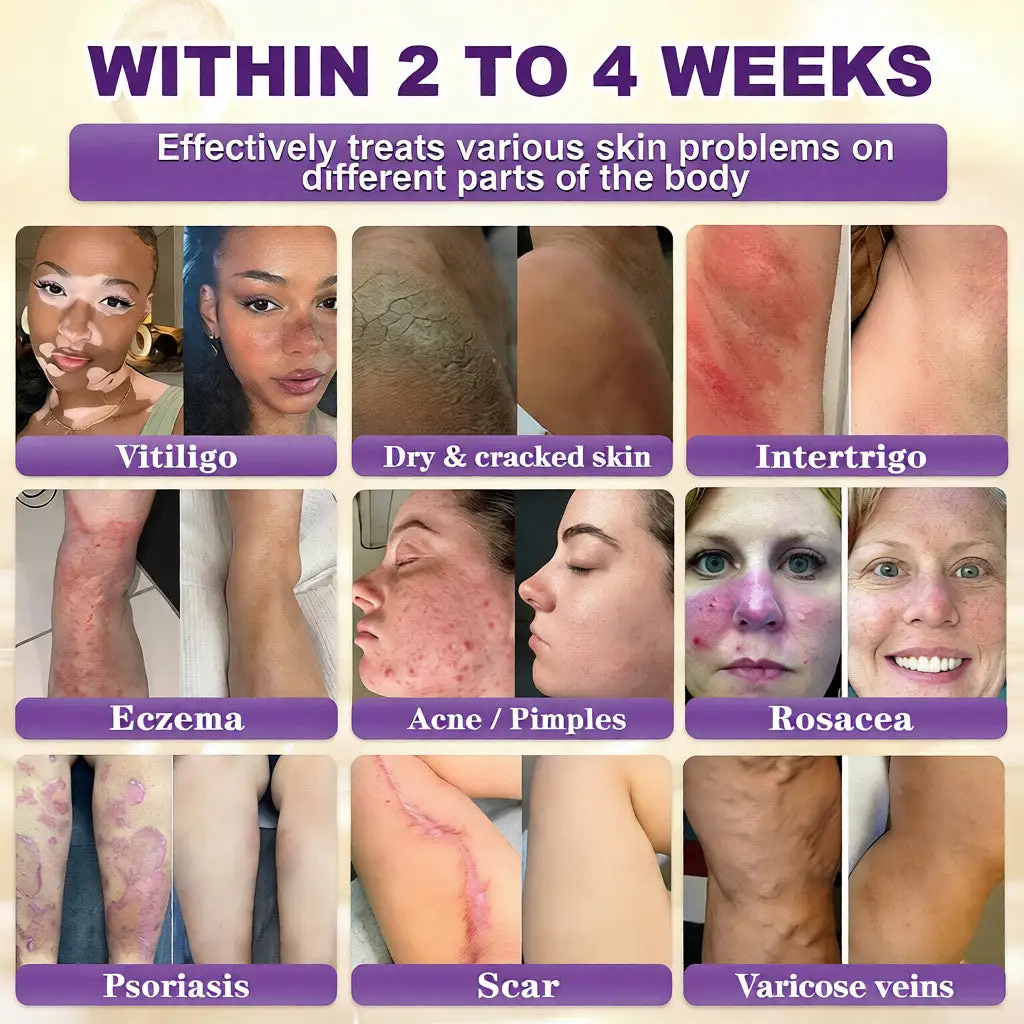 Biotine 10-in-1 Huidherstelcrème - Afbeelding 2