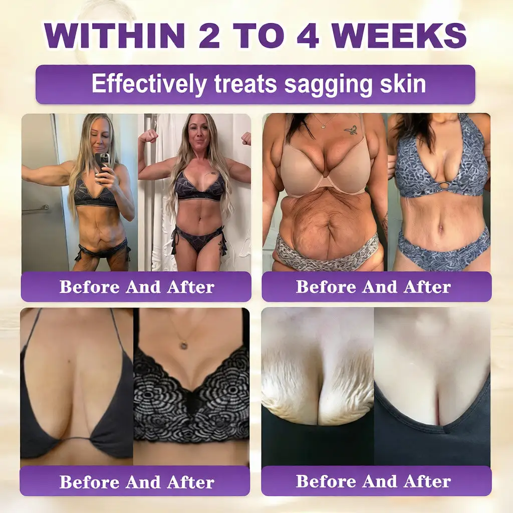 Biotine 10-in-1 Huidherstelcrème - Afbeelding 3