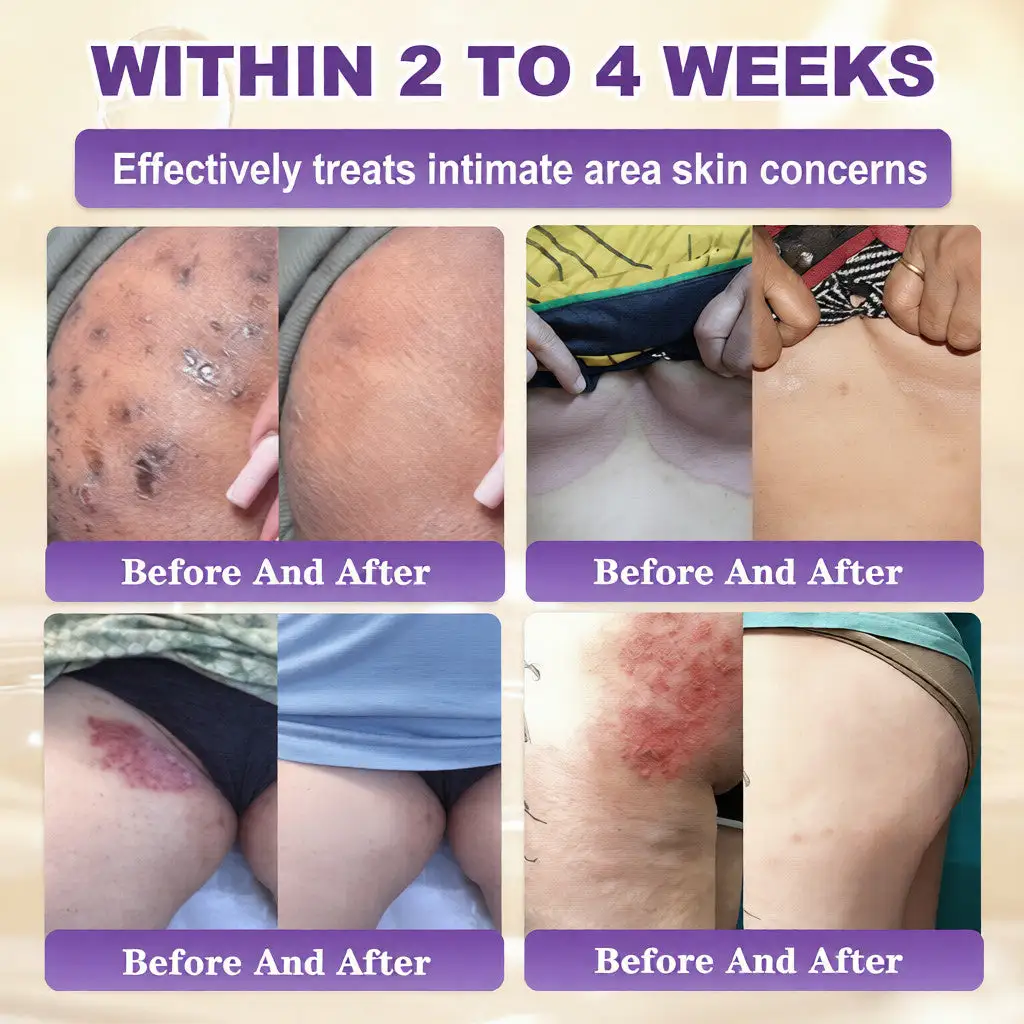 Biotine 10-in-1 Huidherstelcrème - Afbeelding 4