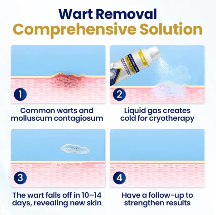 Chillique Bump Vernieuwingsspray - Afbeelding 3